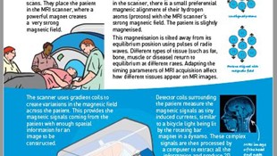Seeing inside the body with MRI poster